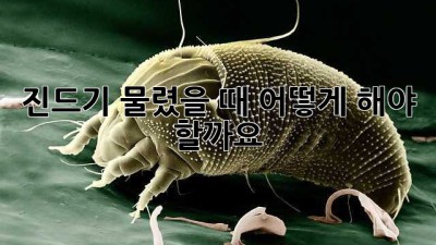 진드기 물렸을 때, 어떻게 해야 할까요?